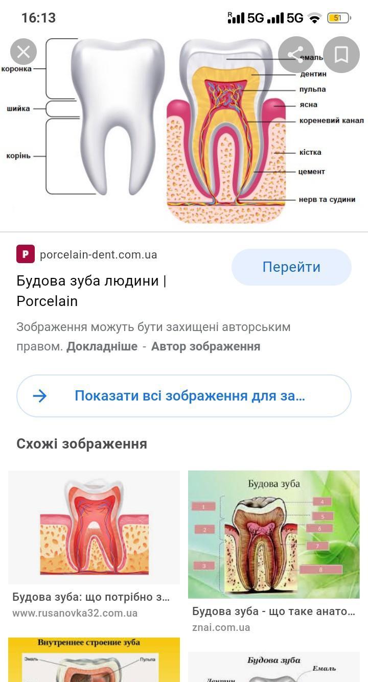 Зуб це. Ретинированный дистопированный зуб мудрости. Зуб це. Зуб це. Зуб це.