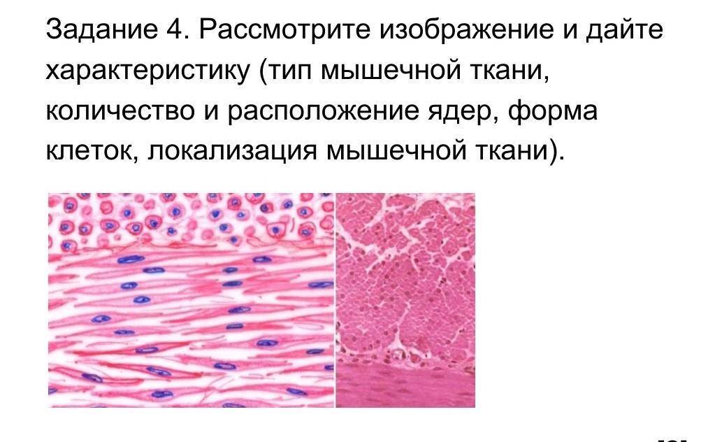 Вид клеток и ядра гладкой мышечной Вид клеток и ядра гладкой мышечной