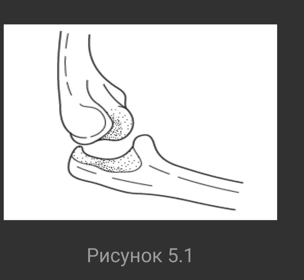 На рисунке изображен сустав