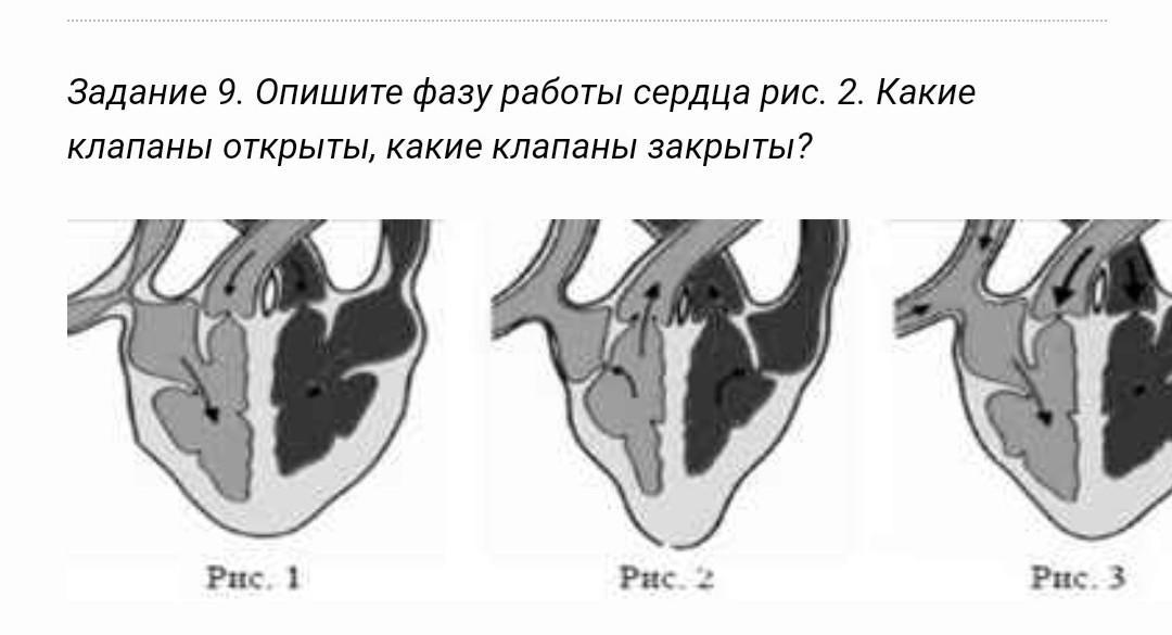 2-025-8, ду 25. Клапан соленоидный нормально открытый. Клапан герметический. Порок сердца открытое овальное окно. Клапан электромагнитный нормально открытый схема.