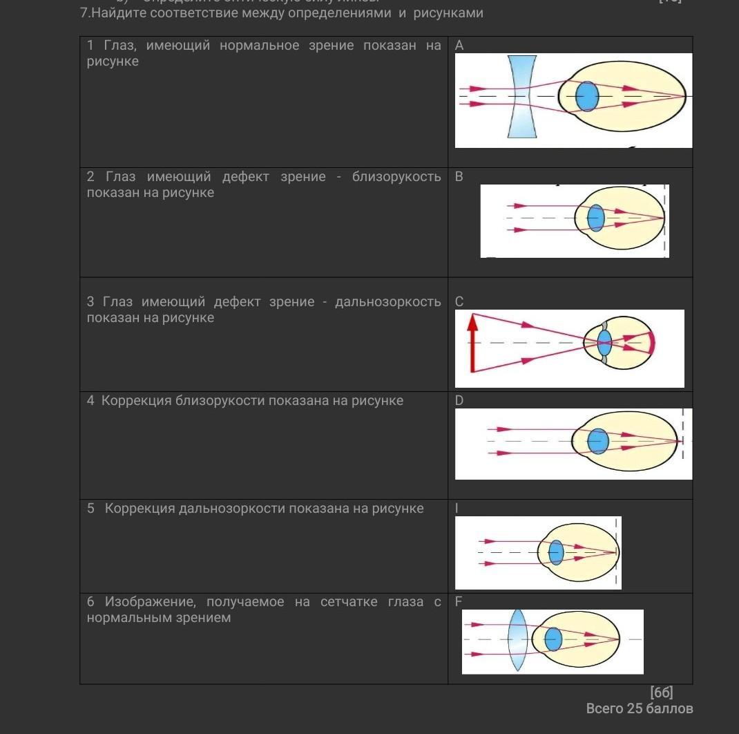 Рис око псков. 7 Найдите соответствие между определениями и рисунками. Дефекты зрения схемы. Глаз дефекты зрения физика. 2 Дефекта зрения с рисунками.